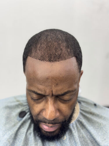 Scalp micropigmentation result by Shaun Fade — Metairie, LA