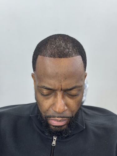 Scalp micropigmentation result by Shaun Fade — Metairie, LA